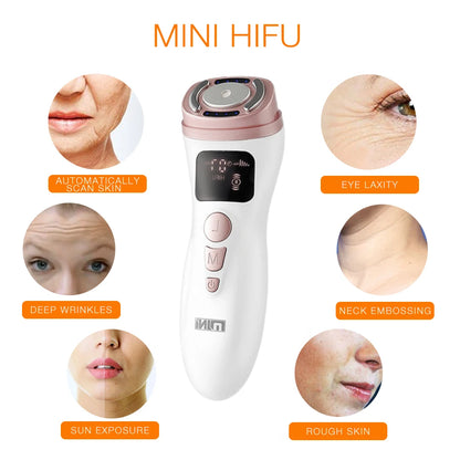 Mini Hifu Machine Ultrasonic Rf