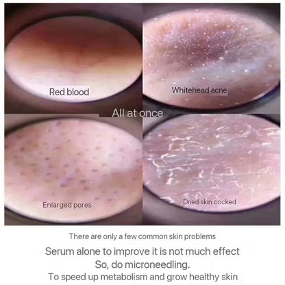 10Pcs Sponge Microcrystal Freeze Dried