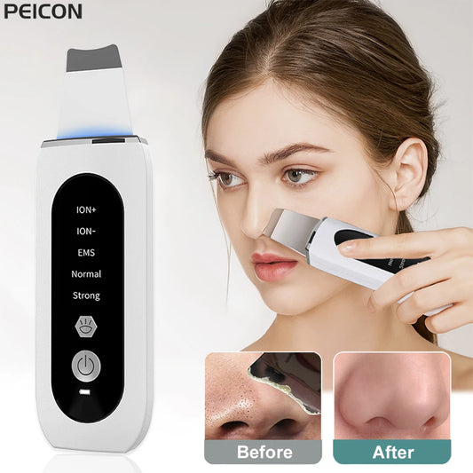 Ultrasonic Skin Scrubber Peeling Blackhead