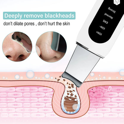 Ultrasonic Skin Scrubber Peeling Blackhead