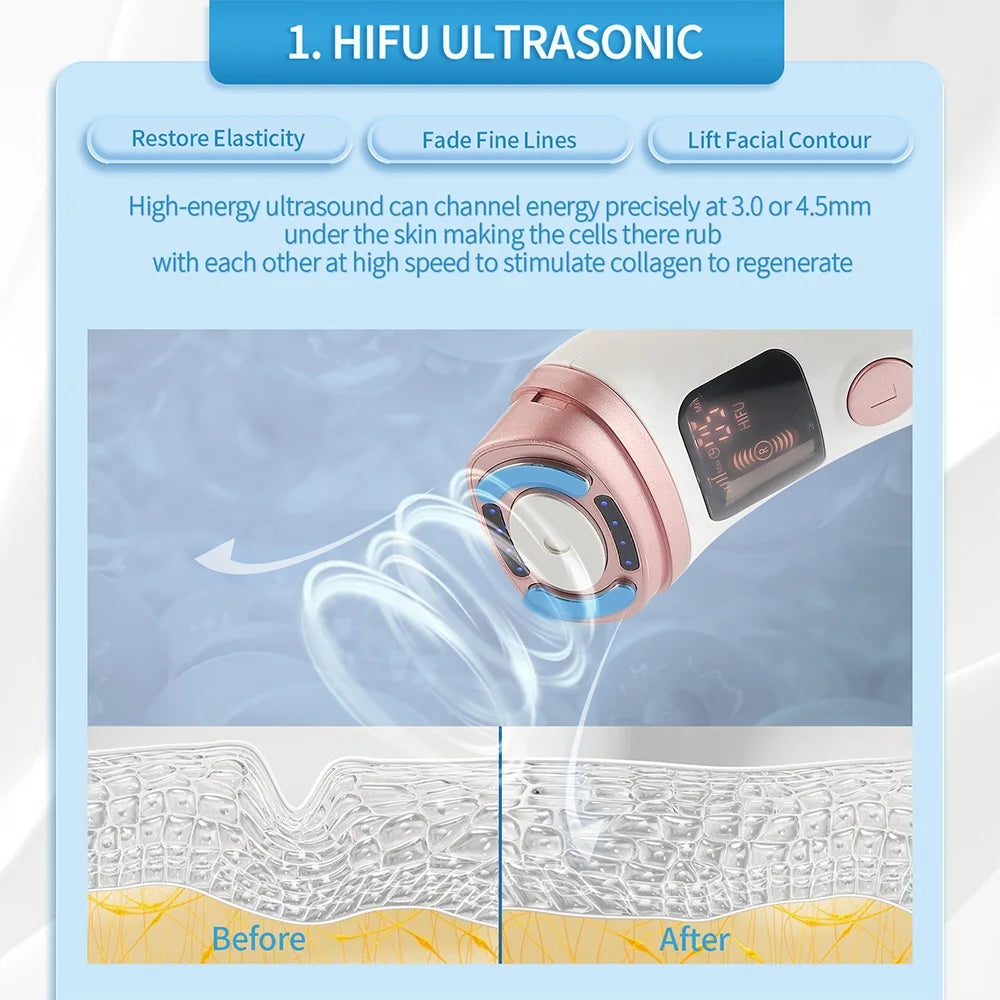 Mini Hifu Machine Ultrasonic Rf